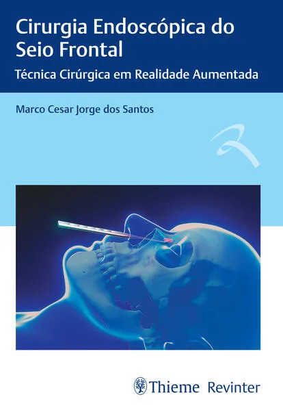 Cirurgia Endoscópica do Seio Frontal:
