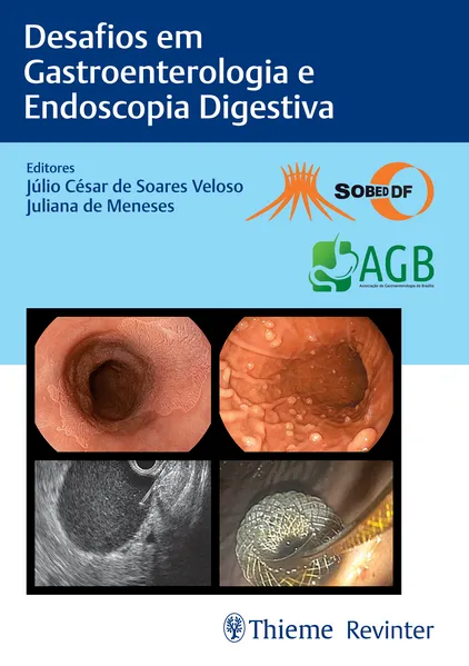 SOBED Desafios em Gastroenterologia e Endoscopia Digestiva: