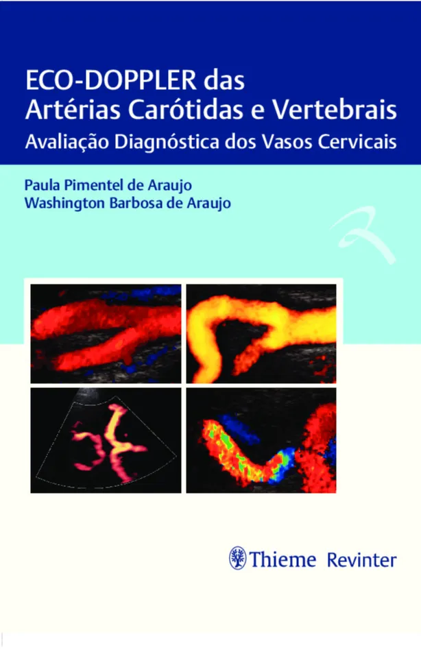 Eco-Doppler Das Artérias Carótidas E Vertebrais: Avaliação Diagnóstica ...
