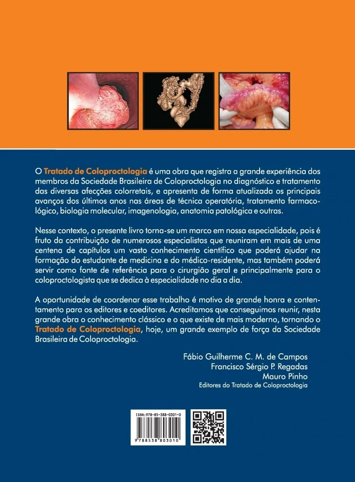 Tratado de coloproctologia: Uma obra dos membros da Sociedade Brasileira de Coloproctologia Tratado de coloproctologia: Uma obra dos membros da Sociedade Brasileira de Coloproctologia - Imagem 2