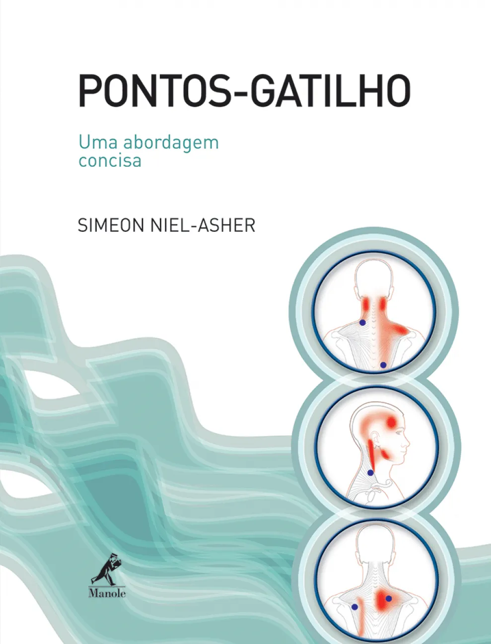 Pontos-gatilho Pontos-gatilho