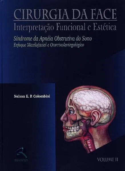 Cirurgia da Face Interpretação Funcional e Estética – Volume II: Síndrome da Apneia Obstrutiva do Sono – Enfoque Maxilofacial e otorrinolaringológico