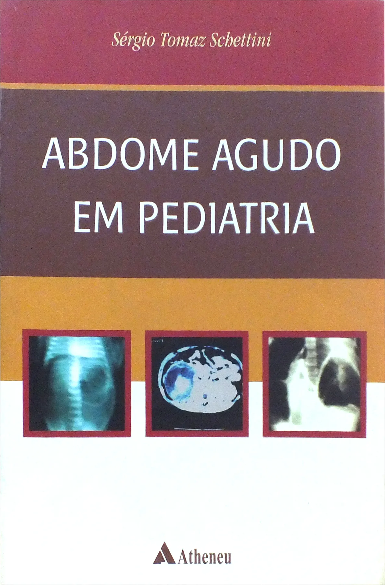 Abdome agudo em pediatria Abdome agudo em pediatria
