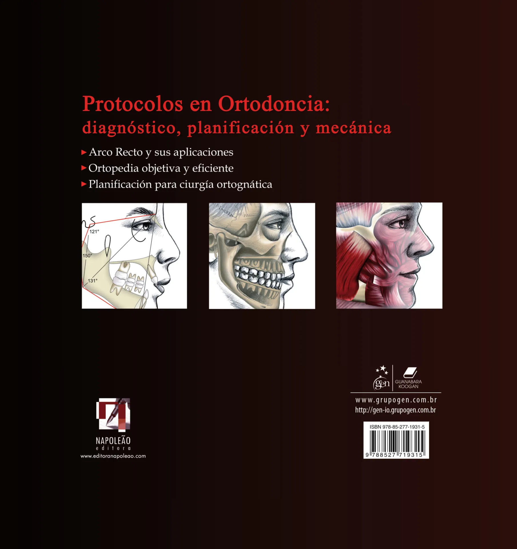 Protocolos en ortodoncia: diagnóstico, planificación y mecánica Protocolos en ortodoncia: diagnóstico, planificación y mecánica - Imagem 2