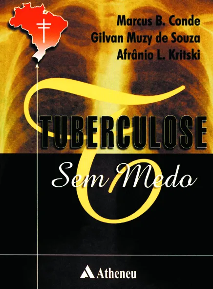 Tuberculose sem medo Tuberculose sem medo