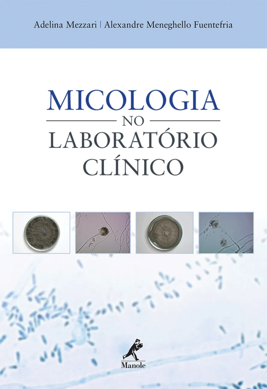 Micologia no laboratório clínico Micologia no laboratório clínico